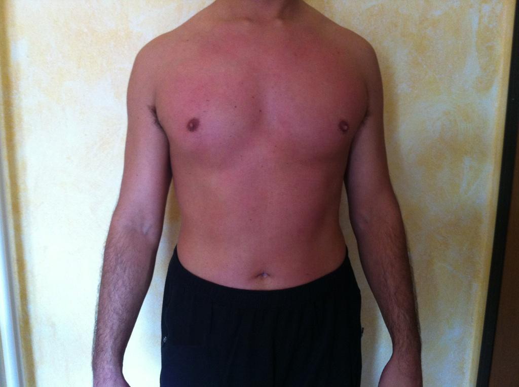 EPILAZ UOMO2